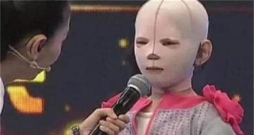  众人|6岁女孩一直戴头套上学，受尽同学白眼，摘下头套后众人湿了眼眶