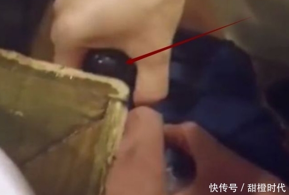 发现|男子请客去饭店吃饭,发现腿上有东西在爬,撸起裤子不淡定了