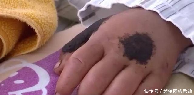  昏迷|2岁男童昏迷10多天 很多孩子都喜欢这么做