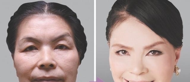 整容|62岁老奶奶花巨资整容10次,只为让自己变得像赵雅芝一样美