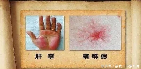  人体内|肝最怕你做8件事，第5件很多人忍不住，第8件最严重