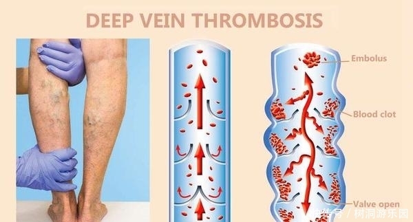  称为|这种蔬菜被称为“血栓斑块清道夫”，想血管畅通，日常不妨多吃点