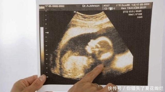 场所|为啥孕妇不能去“喜庆”的场所？不是别人矫情，而是考虑4件事