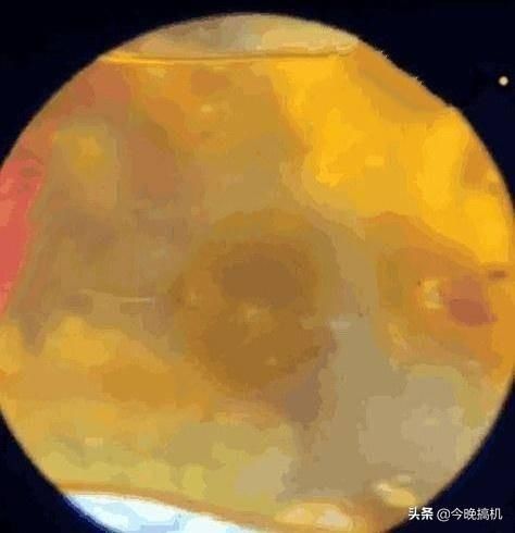 垃圾|辣条到底是不是垃圾食品显微镜下放大120倍,终于敢大胆地吃了