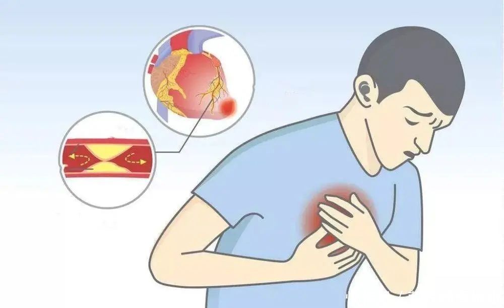 信号|暑去天渐凉,心脑血管病高发,一旦出现6个“信号”,去检查一下