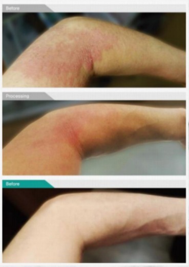  治疗|日本最先端保养品，干细胞上清液！