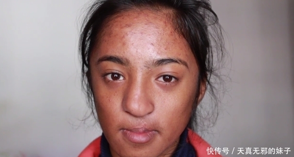 妹子|化妆师帮助毁容女子重拾自信,看到变美之后的她忍不住哭了起来。