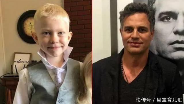  妹狂魔|“宁愿自己被咬死”6岁男孩为了救妹，遭疯狗咬伤，脸部缝了90针