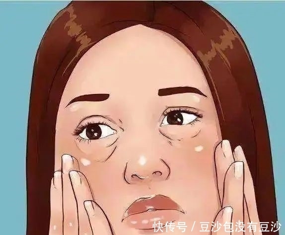 小林|27岁女子,突发猝死,身体出现1肿、2紫、3多,去查查心脏