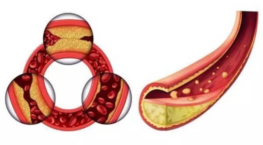 胆固醇|花生又叫长寿果,到底好处在哪里你知道吗
