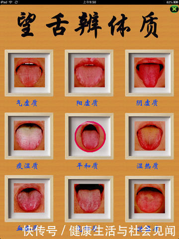 蛋蛋姐|你的身体有没有气虚、血虚、瘀血、寒气、湿气?