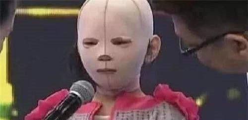  众人|6岁女孩一直戴头套上学，受尽同学白眼，摘下头套后众人湿了眼眶