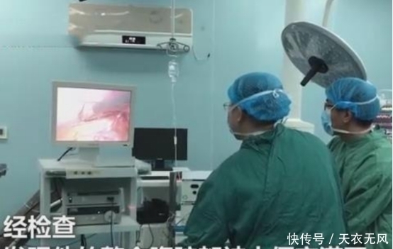  吃完饭|男子吃完饭，肚子一声闷响就痛得流汗，经检查：肚子“爆炸”了