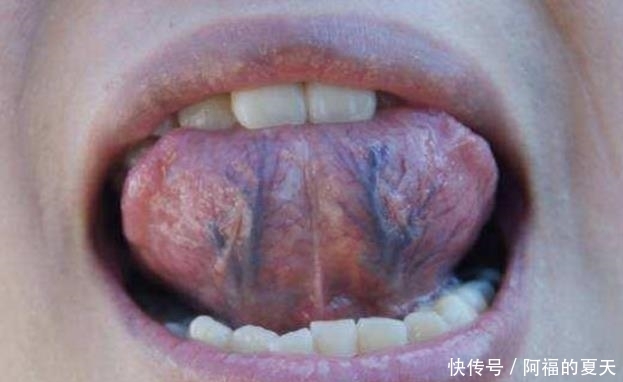 求助|伸出“舌头”,若出现4种“状况”,可能是在向你“求助”!